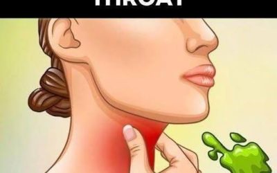 The Real Causes of Constant Phlegm and Mucus in Throat and How to Get Rid of It