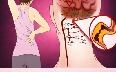 10 Early Warning Signs of a Stroke Everyone Should Know to Take Prompt Action onJuly 12, 2026