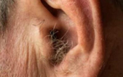Did you know that if your ear hairs grow, it is because your body is… See more  authoronJuly 3, 2026Leave a Comment