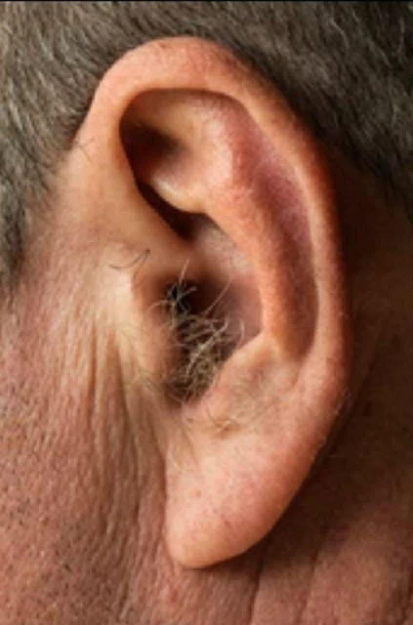 Did you know that if your ear hairs grow, it is because your body is… See more  authoronJuly 3, 2026Leave a Comment