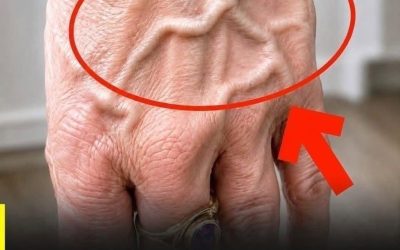 If you have visible veins, it means you are…