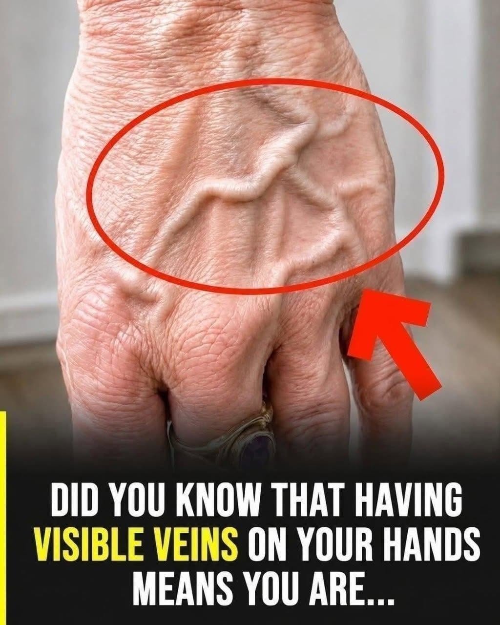 If you have visible veins, it means you are…