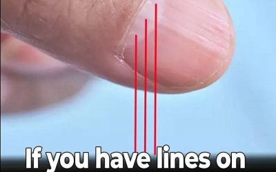 Doctor Uncovers A Telltale Sign In Your Fingernails That May Predict Your Life Expectancy – Weeknight Bites