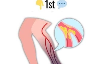 10 Warning Signs of a Blood Clot in the Leg You Should Know