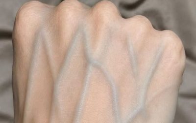 If your veins are visible in your hand, it is a signal