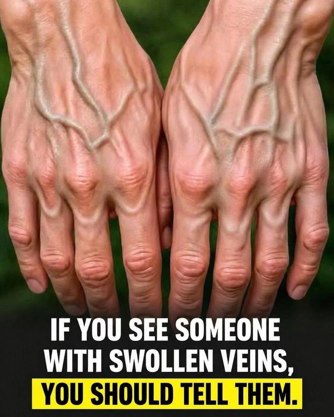 If your veins are visible, it means you are… See more1