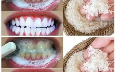 “I tried this 1-minute trick with ingredients I had in my kitchen… The result: My teeth became instantly whiter.”