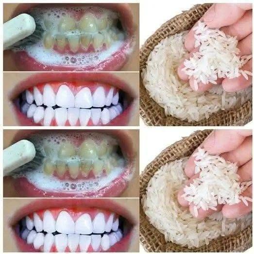 “I tried this 1-minute trick with ingredients I had in my kitchen… The result: My teeth became instantly whiter.”